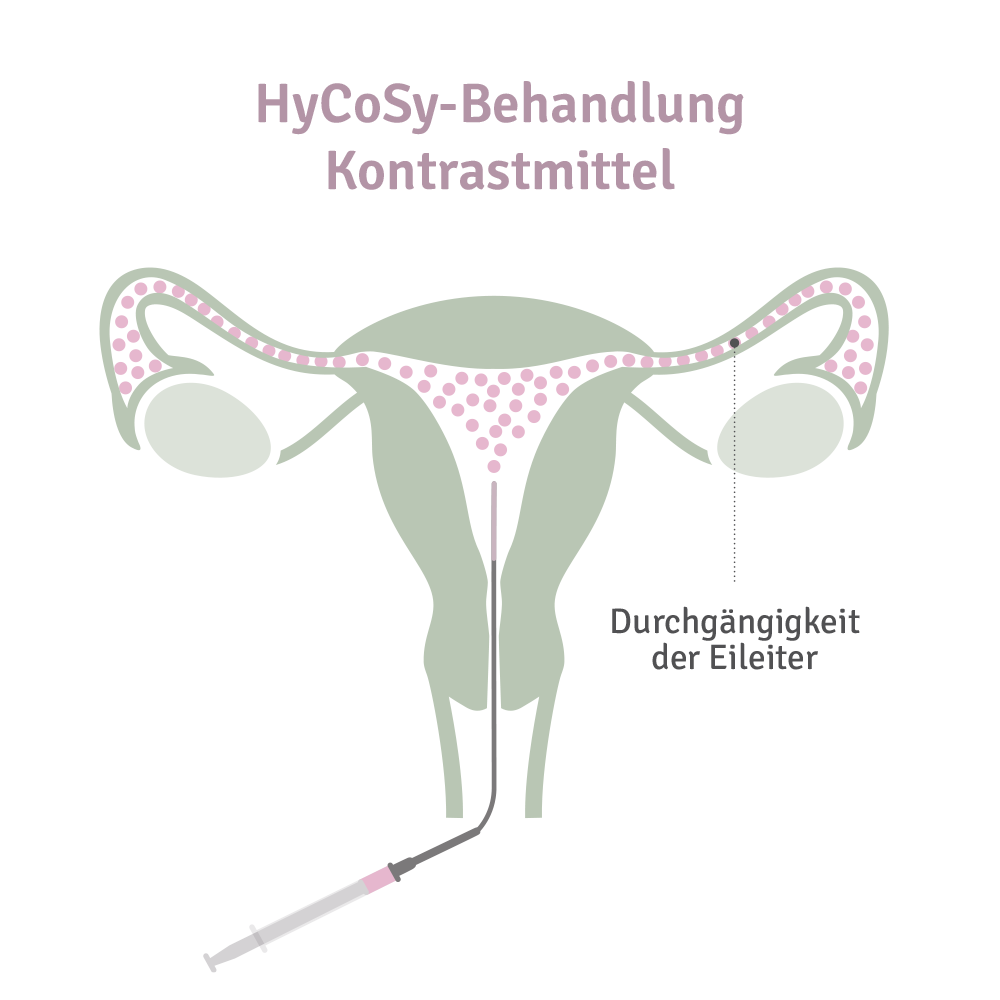 HyCosy Kontrastmittel